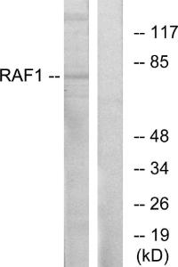 Western blot analysis of lysates from HT-29 cells using Anti-C-RAF Antibody. The right hand lane represents a negative control, where the antibody is blocked by the immunising peptide