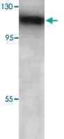 Anti-AHR Rabbit Polyclonal Antibody