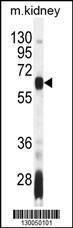 Anti-AIRE Rabbit Polyclonal Antibody (PE (Phycoerythrin))