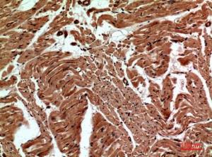 Immunohistochemical analysis of paraffin-embedded human heart using Anti-CD59 Antibody