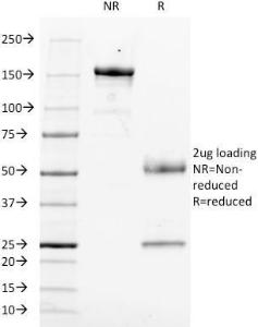 SDS-PAGE analysis of Anti-CD14 Antibody [LPSR/553] under non-reduced and reduced conditions; showing intact IgG and intact heavy and light chains, respectively. SDS-PAGE analysis confirms the integrity and purity of the antibody