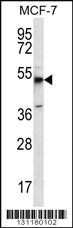 Anti-CEBPD Rabbit Polyclonal Antibody