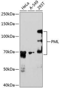 Western blot analysis of extracts of various cell lines, using Anti-PML Protein Antibody [ARC0125] (A307256) at 1:1,000 dilution. The secondary antibody was Goat Anti-Rabbit IgG H&L Antibody (HRP) at 1:10,000 dilution.