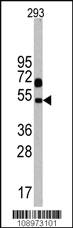 Anti-NP1(Nptx1) Rabbit Polyclonal Antibody