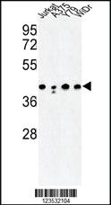 Anti-CANT1 Rabbit Polyclonal Antibody