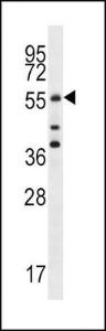 Anti-CDC25A Rabbit Polyclonal Antibody (Biotin)