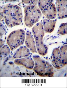 Anti-RPL23 Rabbit Polyclonal Antibody (FITC (Fluorescein Isothiocyanate))