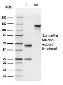 Antibody anti-C1QB C1QB2962 100 µg