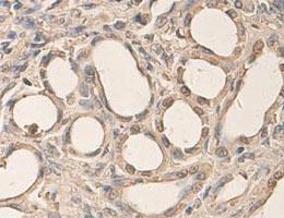 Anti-AHR Rabbit Polyclonal Antibody