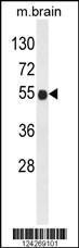 Anti-B3GNT6 Rabbit Polyclonal Antibody (AP (Alkaline Phosphatase))