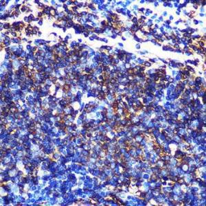 Immunohistochemistry analysis of paraffin-embedded mouse spleen using Anti-HLA-DQA1 Antibody [ARC0564] (A305719) at a dilution of 1:100 (40x lens). Perform microwave antigen retrieval with 10 mM PBS buffer pH 7.2 before commencing with IHC staining protocol.