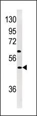 Anti-NP1(Nptx1) Rabbit Polyclonal Antibody