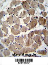 Anti-COCH Rabbit Polyclonal Antibody (Biotin)