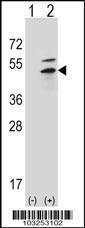 Anti-PRKAR2B Rabbit Polyclonal Antibody (HRP (Horseradish Peroxidase))