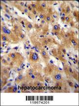 Anti-AHSG Rabbit Polyclonal Antibody (PE (Phycoerythrin))