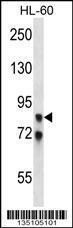 Anti-AKAP4 Rabbit Polyclonal Antibody (AP (Alkaline Phosphatase))