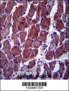 Anti-FIZ1 Rabbit Polyclonal Antibody (FITC (Fluorescein Isothiocyanate))