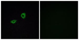 Immunofluorescence analysis of A549 cells using Anti-CHRM5 Antibody. The right hand panel represents a negative control, where the Antibody was pre-incubated with the immunising peptide