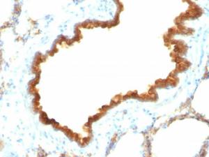 Immunohistochemical analysis of formalin-fixed, paraffin-embedded rat lung using Anti-Cytokeratin 19 Antibody [KRT19/800]