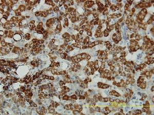 Anti-ALDH4A1 Mouse Monoclonal Antibody [clone: 1A12-A5]