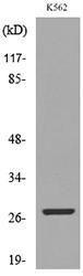 Western blot analysis of lysate from K562 cells using Anti-CD58 Antibody