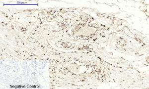 Immunohistochemical analysis of paraffin-embedded human breast tissue using Anti-Cox2 Antibody at 1:200 (4°C overnight). Negative control was secondary antibody only.