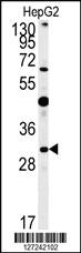 Anti-RNF208 Rabbit Polyclonal Antibody