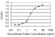 Anti-PHIP Mouse Monoclonal Antibody [clone: 4D7]