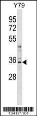 Anti-YBX3 Rabbit Polyclonal Antibody (APC (Allophycocyanin))