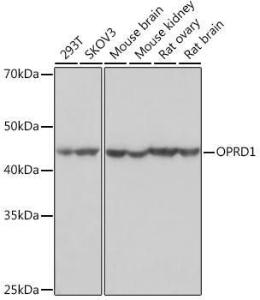 Anti-Delta Opioid Receptor Rabbit Monoclonal Antibody [clone: ARC1786]