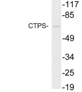 Western blot analysis of lysate from HUVEC cells using Anti-CTPS Antibody