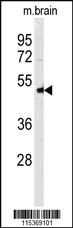 Anti-TNFRSF10A Rabbit Polyclonal Antibody