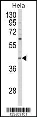 Anti-MAPK13 Rabbit Polyclonal Antibody