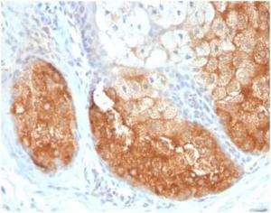 Immunohistochemical analysis of formalin-fixed, paraffin-embedded human skin tissue using Anti-Tyrosinase Antibody [TYR/3826] at 2µg/ml