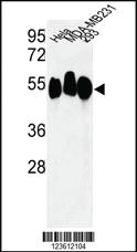 Anti-RBBP7 Rabbit Polyclonal Antibody