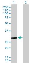 Anti-CACNG3 Mouse Polyclonal Antibody