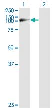 Anti-WWP1 Mouse Monoclonal Antibody [clone: 1A7]