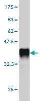 Anti-APOL3 Mouse Monoclonal Antibody [clone: 4E5]