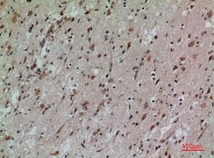 Immunohistochemical analysis of paraffin-embedded human brain using Anti-CD58 Antibody