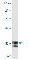 Anti-SCN11A Mouse Monoclonal Antibody [clone: 2B10]