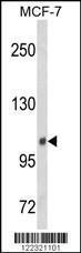 Anti-Inositol Polyphosphate 4-phosphatase Type II Rabbit Polyclonal Antibody (PE (Phycoerythrin))