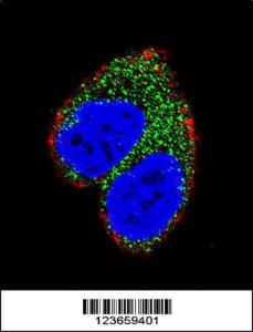 Anti-AIM2 Rabbit Polyclonal Antibody (FITC (Fluorescein Isothiocyanate))