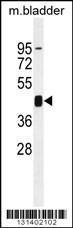 Anti-PRKAG1 Rabbit Polyclonal Antibody (AP (Alkaline Phosphatase))