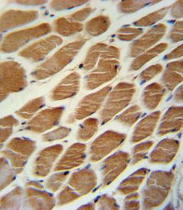 Anti-ACADL Rabbit Polyclonal Antibody (Biotin)