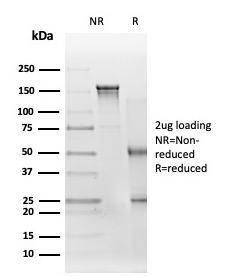 SDS-PAGE analysis of Anti-EIF2S1 Antibody [PCRP-EIF2S1-1C11] under non-reduced and reduced conditions; showing intact IgG and intact heavy and light chains, respectively. SDS-PAGE analysis confirms the integrity and purity of the Antibody