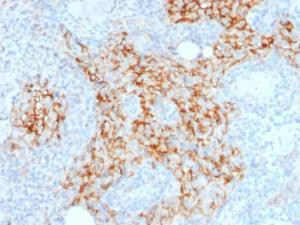 Immunohistochemical analysis of formalin-fixed, paraffin-embedded human lymph node using Anti-CD14 Antibody [LPSR/2385]