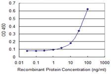 Anti-ALDH4A1 Mouse Monoclonal Antibody [clone: 1A12-A5]