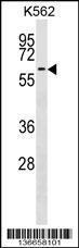 Anti-F9 Rabbit Polyclonal Antibody (HRP (Horseradish Peroxidase))