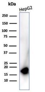 Western blot analysis of Hep2 cell line lysate using Anti-p16INK4a Antibody [rCDKN2A/4845]