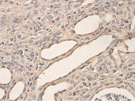 Anti-AHR Rabbit Polyclonal Antibody